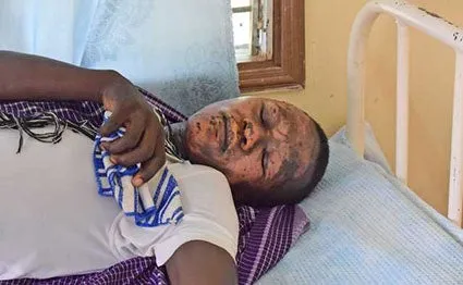 Apollo Atieno Burnt in KCSE 2019