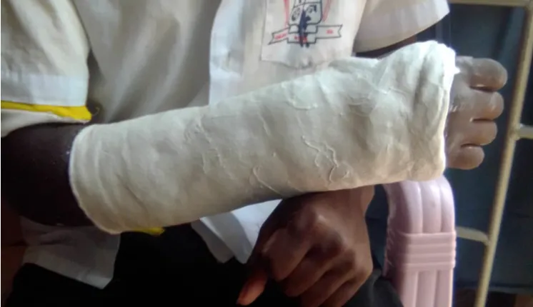 Teacher gets arrested after breaking learner's arm